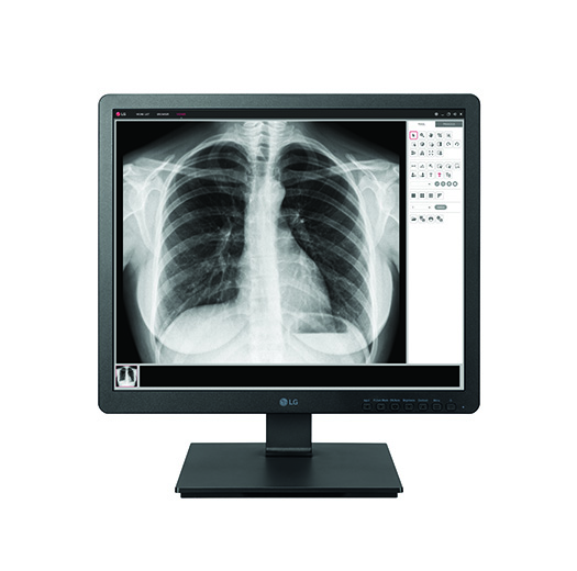 Monitor medicali LG
